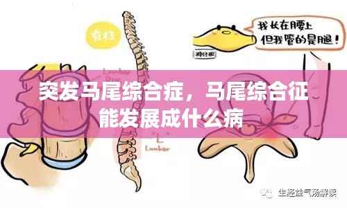 突发马尾综合症，马尾综合征能发展成什么病 