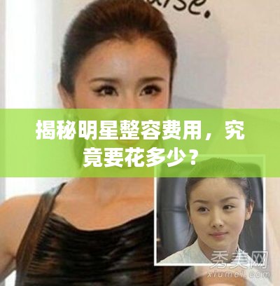 揭秘明星整容费用,究竟要花多少?